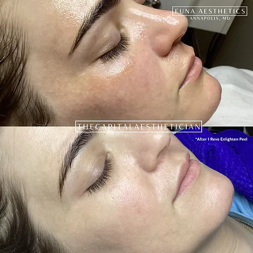 Helloeuna_Skin_Therapy_Five by Euna Aesthetics LLC in Annapolis, MD