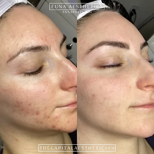 Helloeuna_Skin_Therapy_Seven_ by Euna Aesthetics LLC in Annapolis, MD