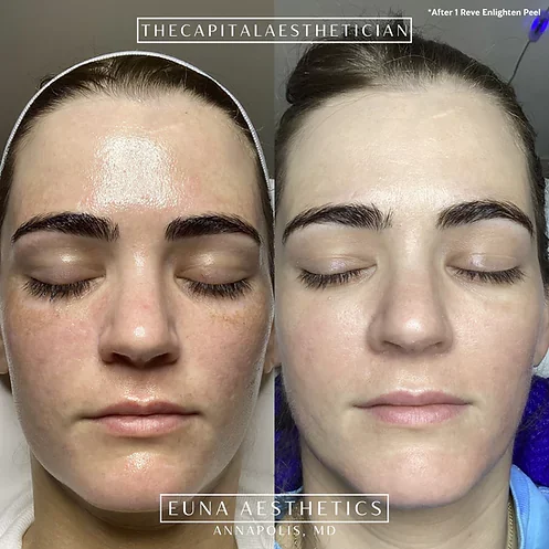 Helloeuna_Skin_Therapy_Two_ by Euna Aesthetics LLC in Annapolis, MD